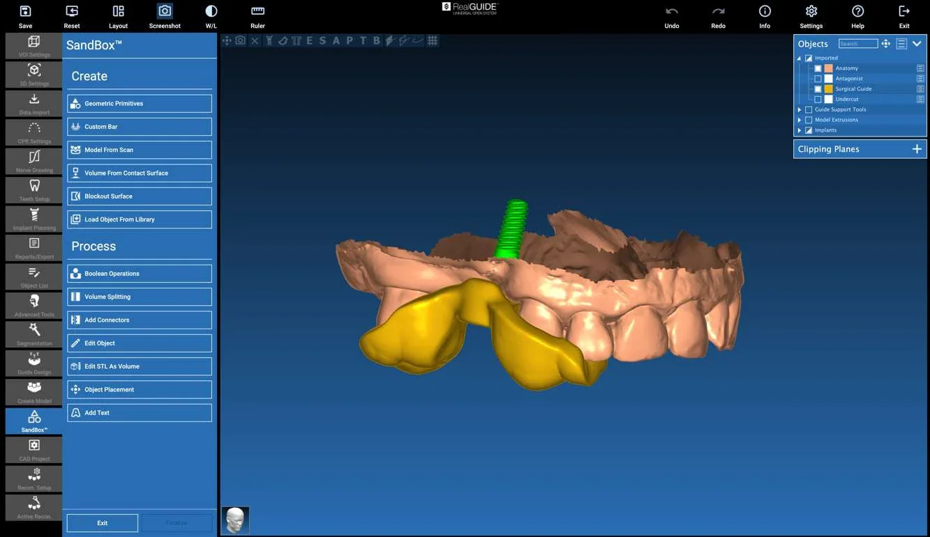 SandBox-module van RealGUIDE met een boormal en implantaat
