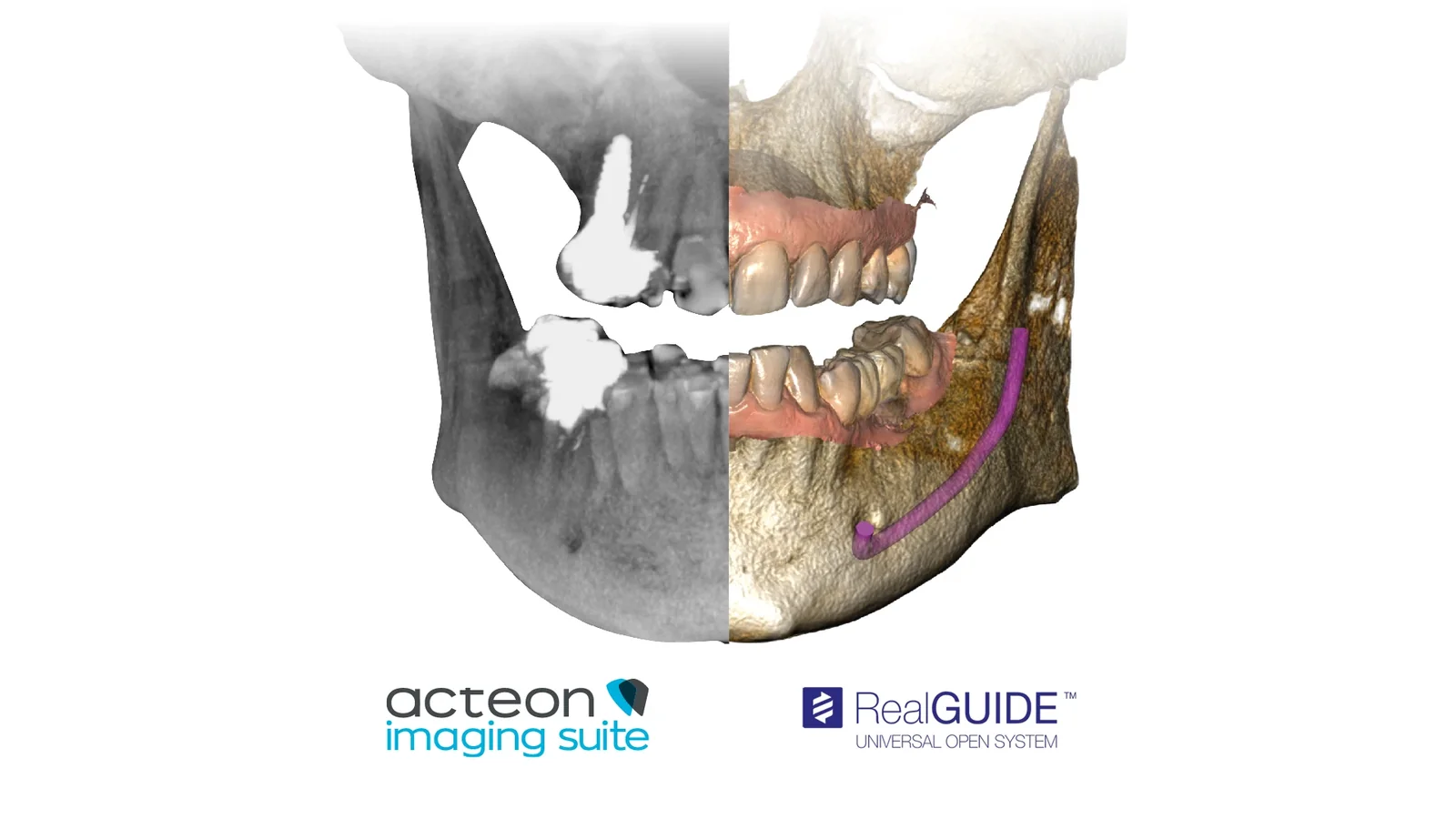 Acteon Imaging Suite en RealGUIDE