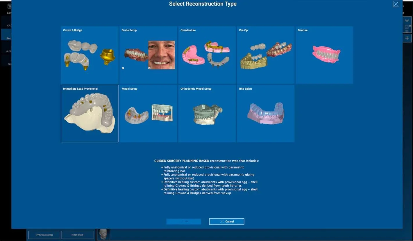 Keuze van het reconstructietype in de CAD-module van RealGUIDE