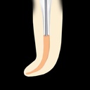 Woodpecker Gutta-Percha Fi-P obturatiesysteem (2)