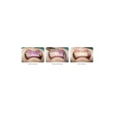 Woodpecker AP-B ultrasoon scaler en airpolisher, wit (5)