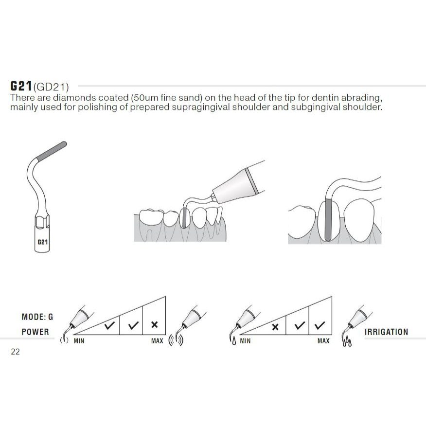 Woodpecker GD21 inlay-tip (2)