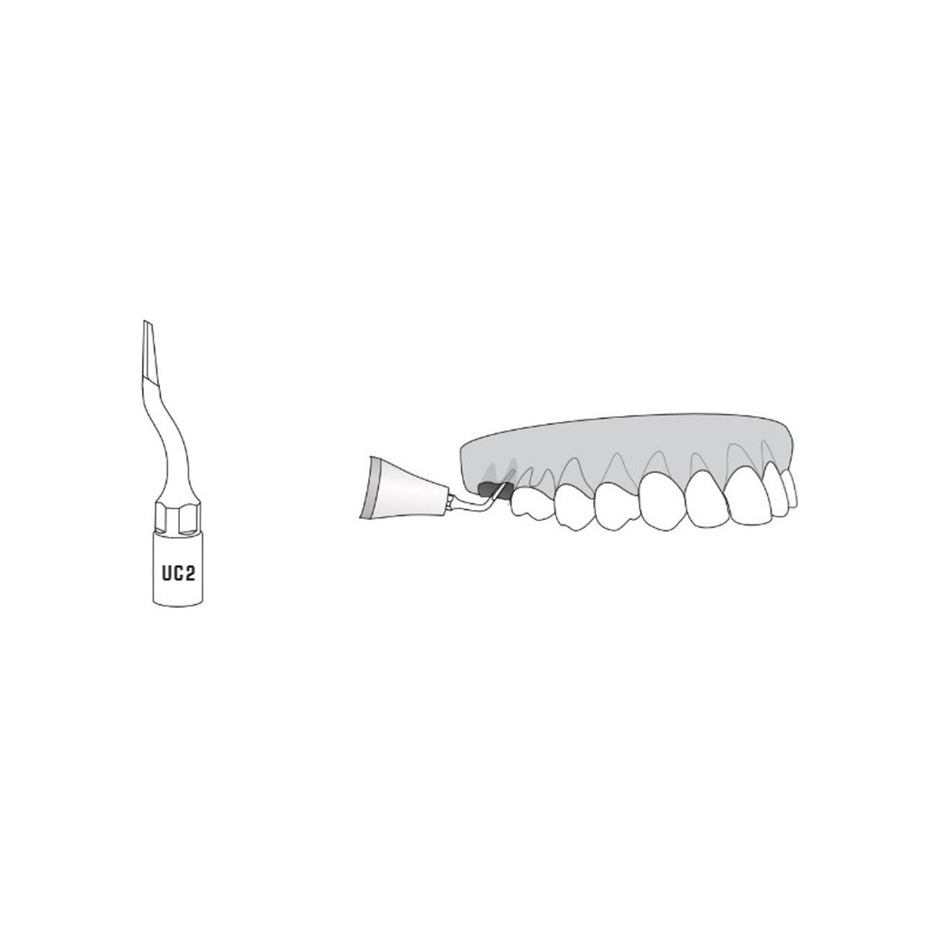 Woodpecker UC2 ultrachirurgische tip voor extractie (2)