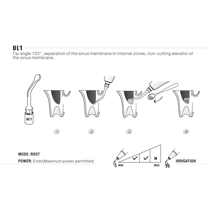 Woodpecker UL1 ultrachirurgische tip voor sinuslift (3)