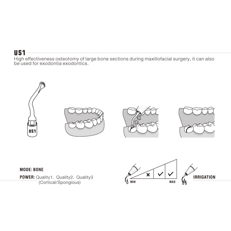 Woodpecker US1 ultrachirurgische tip voor botchirurgie (4)