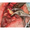 NENTWIG, bone holding and fix.fcps., str (3)