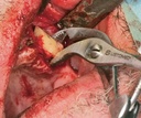 NENTWIG, bone holding and fix.fcps., str (3)