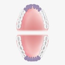 American Eagle Gracey Standard 1-2 curette, XP2 Technology (2)