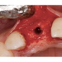 NENTWIG, Bone Spread.Instr., 4pc., baj., sc (2)