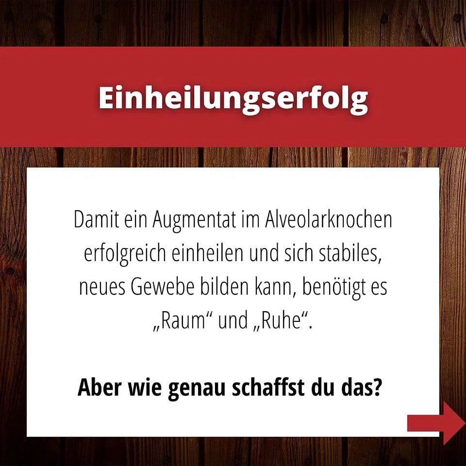SCHLEE, Umbrella-Technique-Set (3)
