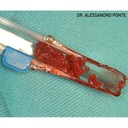 Ustomed Safescraper TWIST botcollector recht steriel (2)