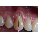 Ustomed ASLAN parodontale sonde 23 mm, kleurcodering, PEEK (2)