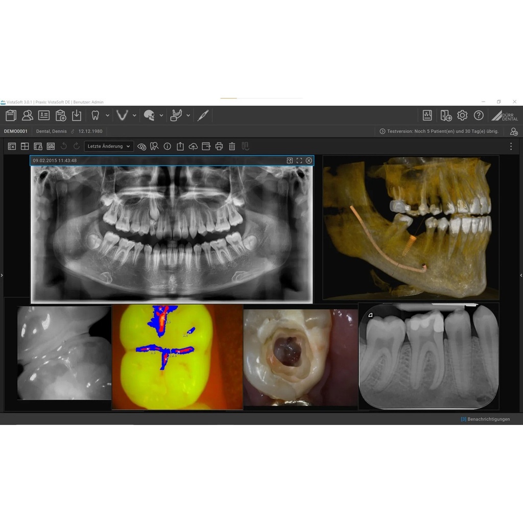 Dürr VistaSoft Connect 4.x